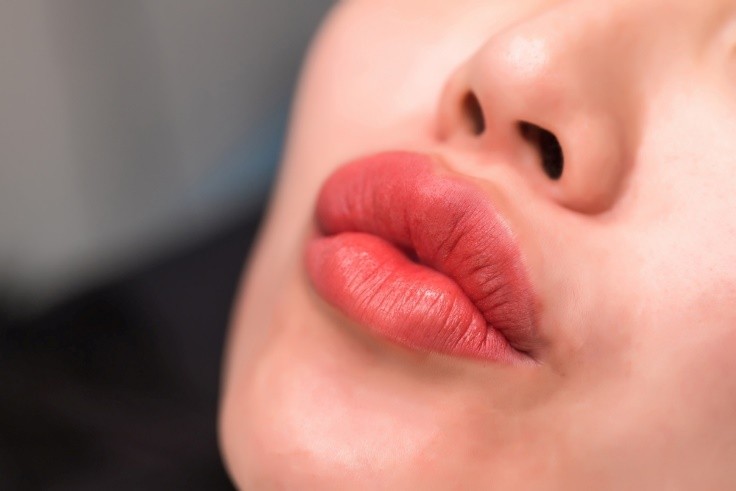 Lip Fillers in Tokyo, Japan:Recommended Clinics