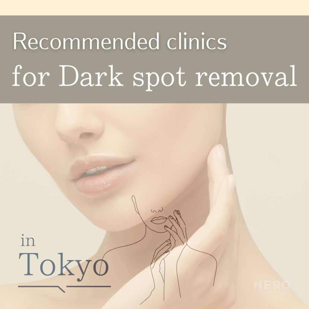 Dark Spot Removal in Tokyo, Japan:Recommended Clinics