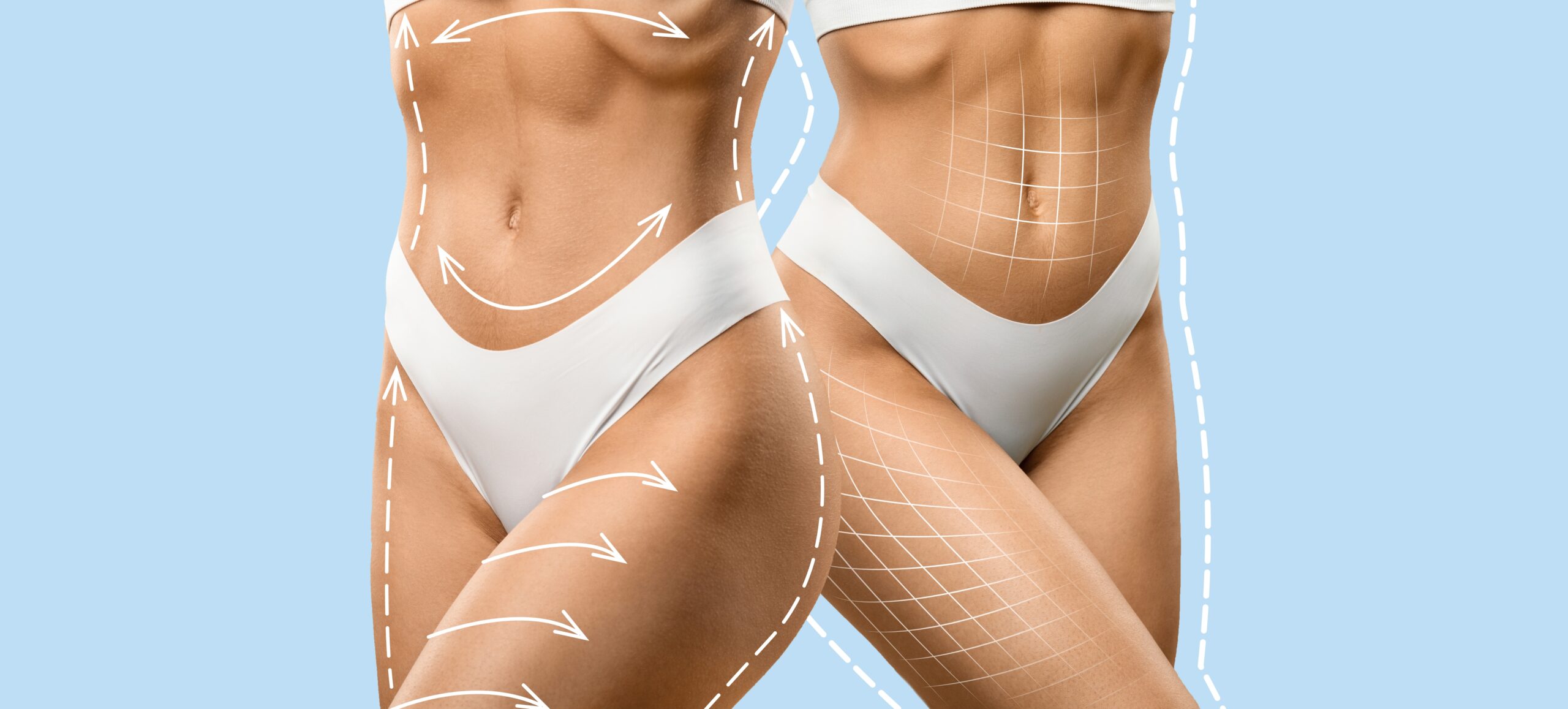 Liposuction Fat Removal in Tokyo: Costs, Safety, and Before & After Guide