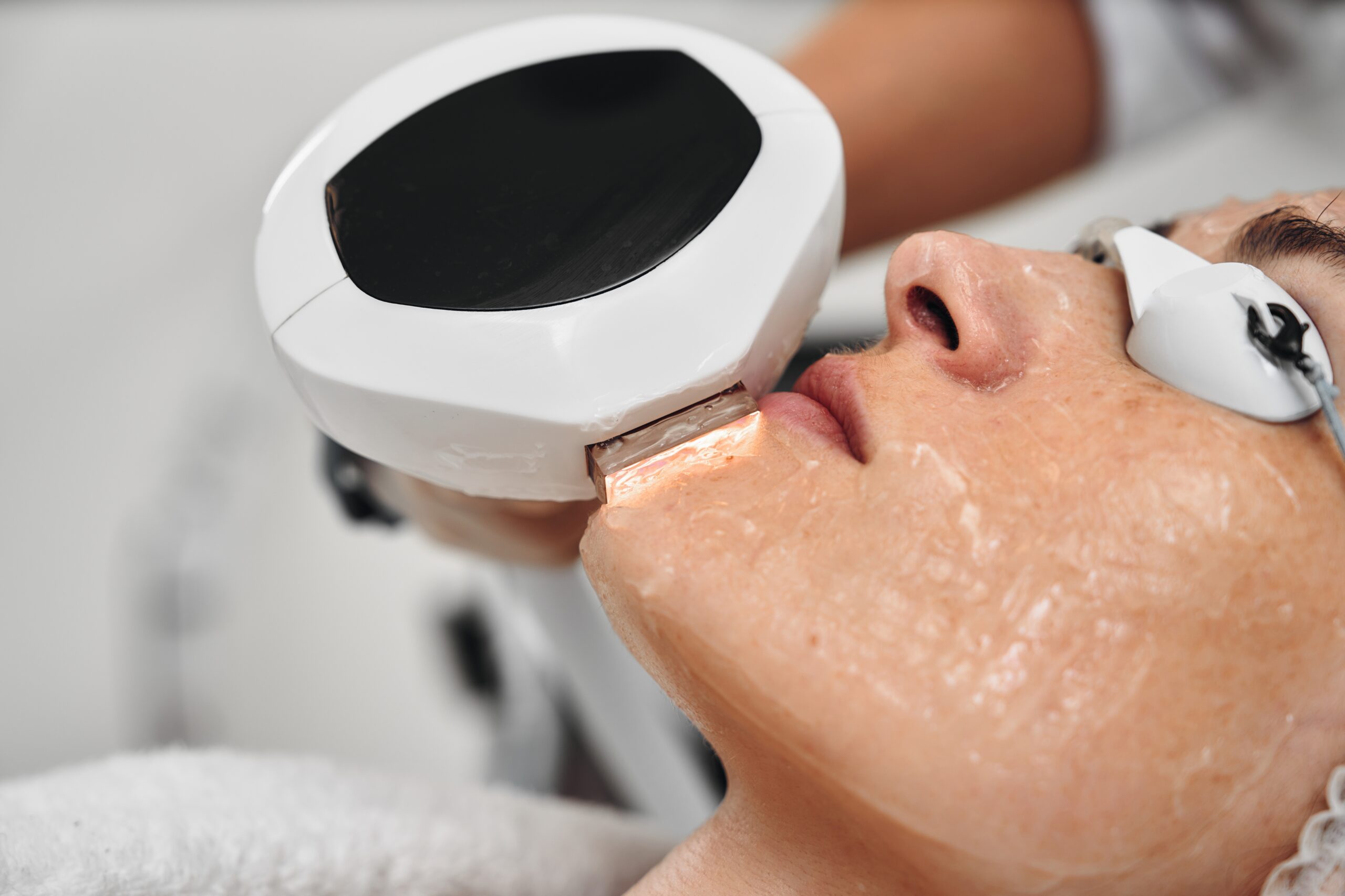 Laser Treatment for Skin in Tokyo: Options, Safety, and Before & After Results