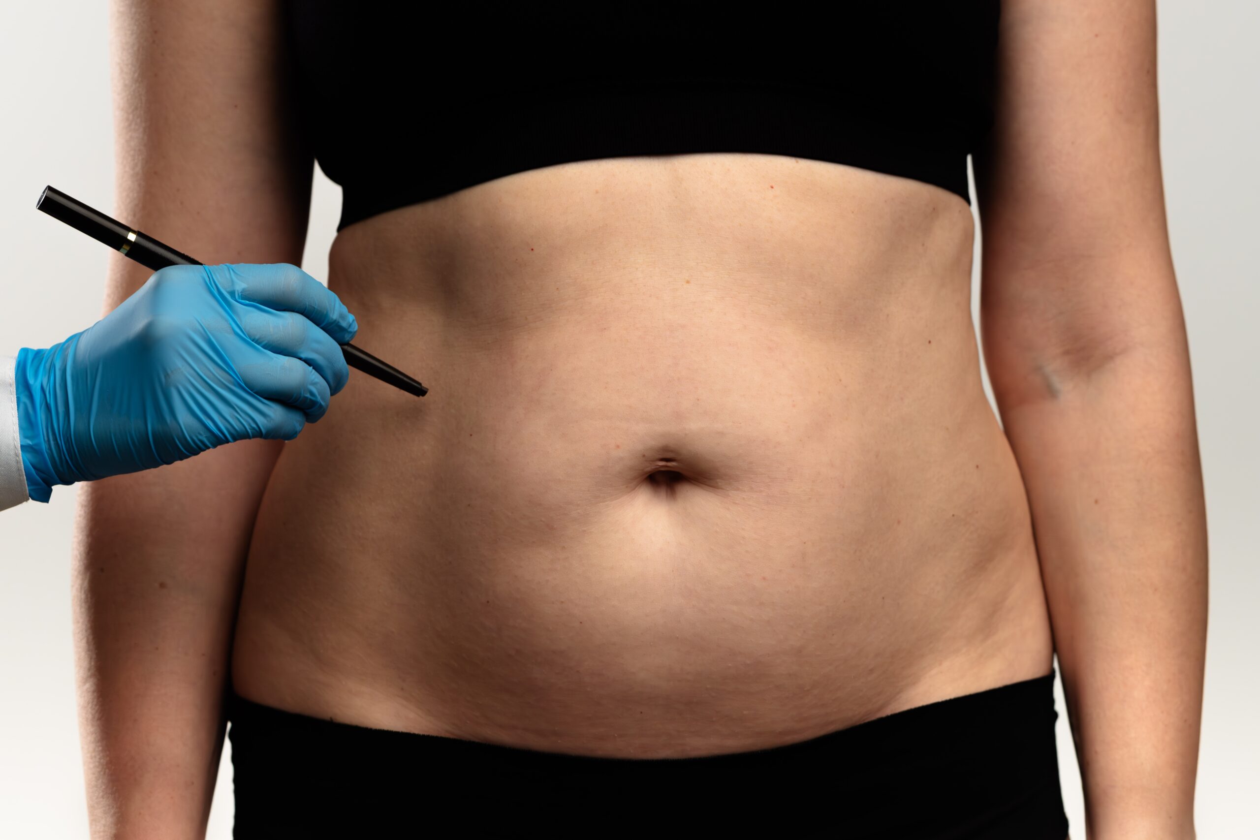 Liposuction Fat Removal in Tokyo: Costs, Safety, and Before & After Guide