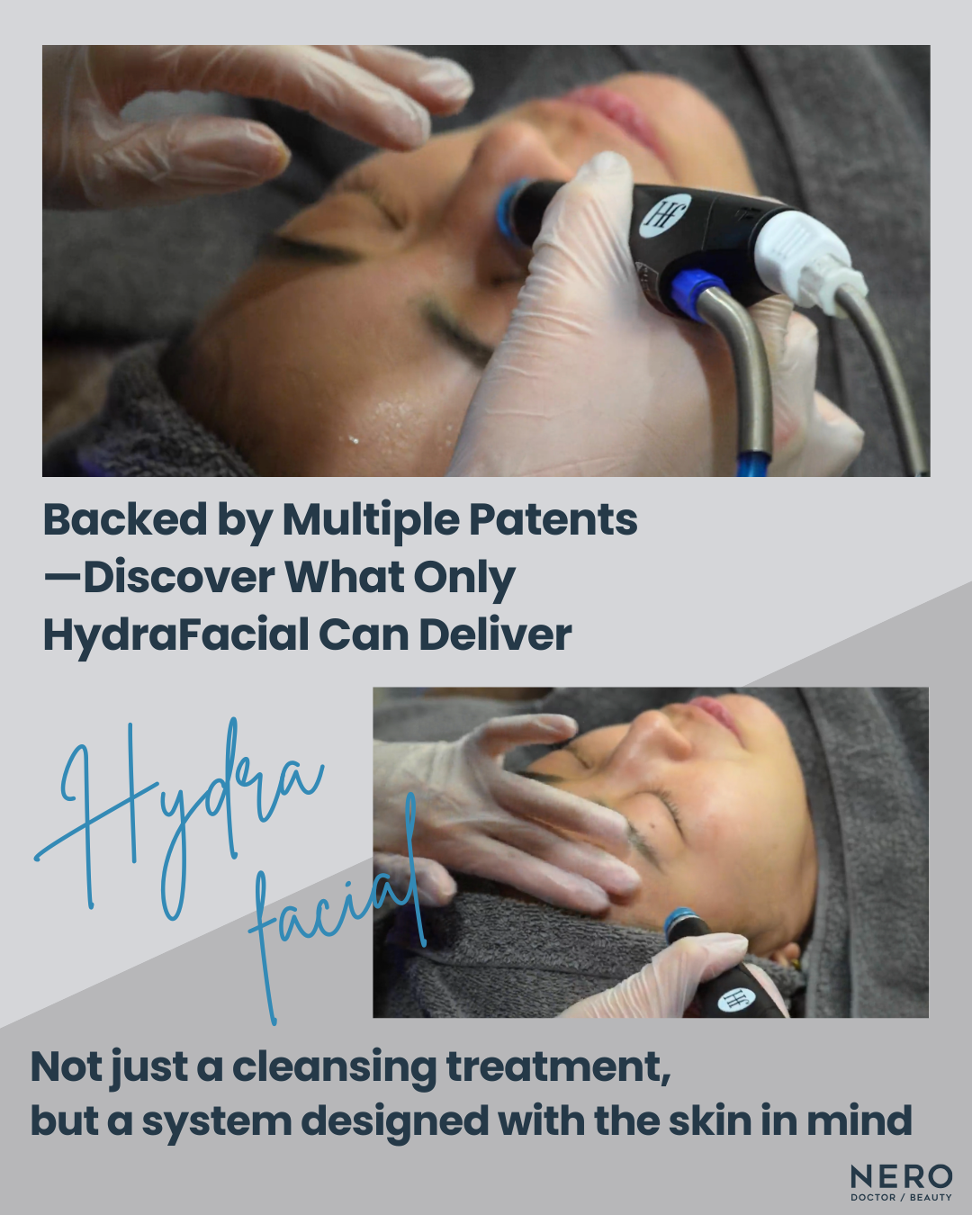 The True Value of Hydrafacial: Why Skin Preparation Matters in Modern Aesthetic Treatments
