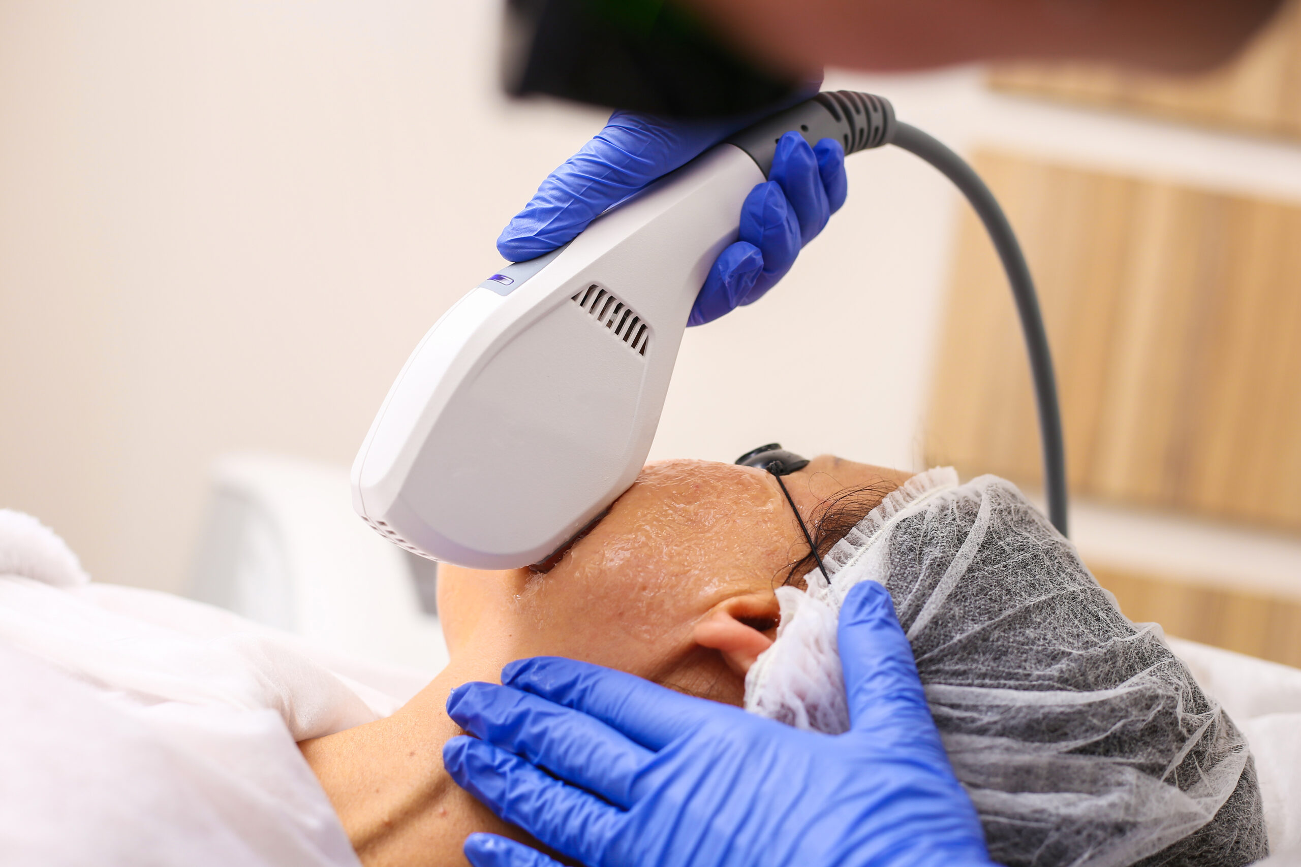 Best Laser Treatments in Tokyo for Pigmentation, Pores, and Acne Scars