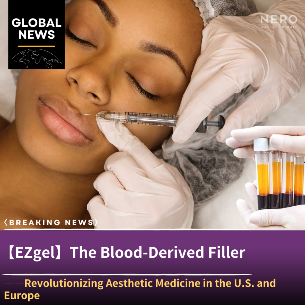 EZgel: The Blood-Derived Filler Revolutionizing Aesthetic Medicine in the U.S. and Europe