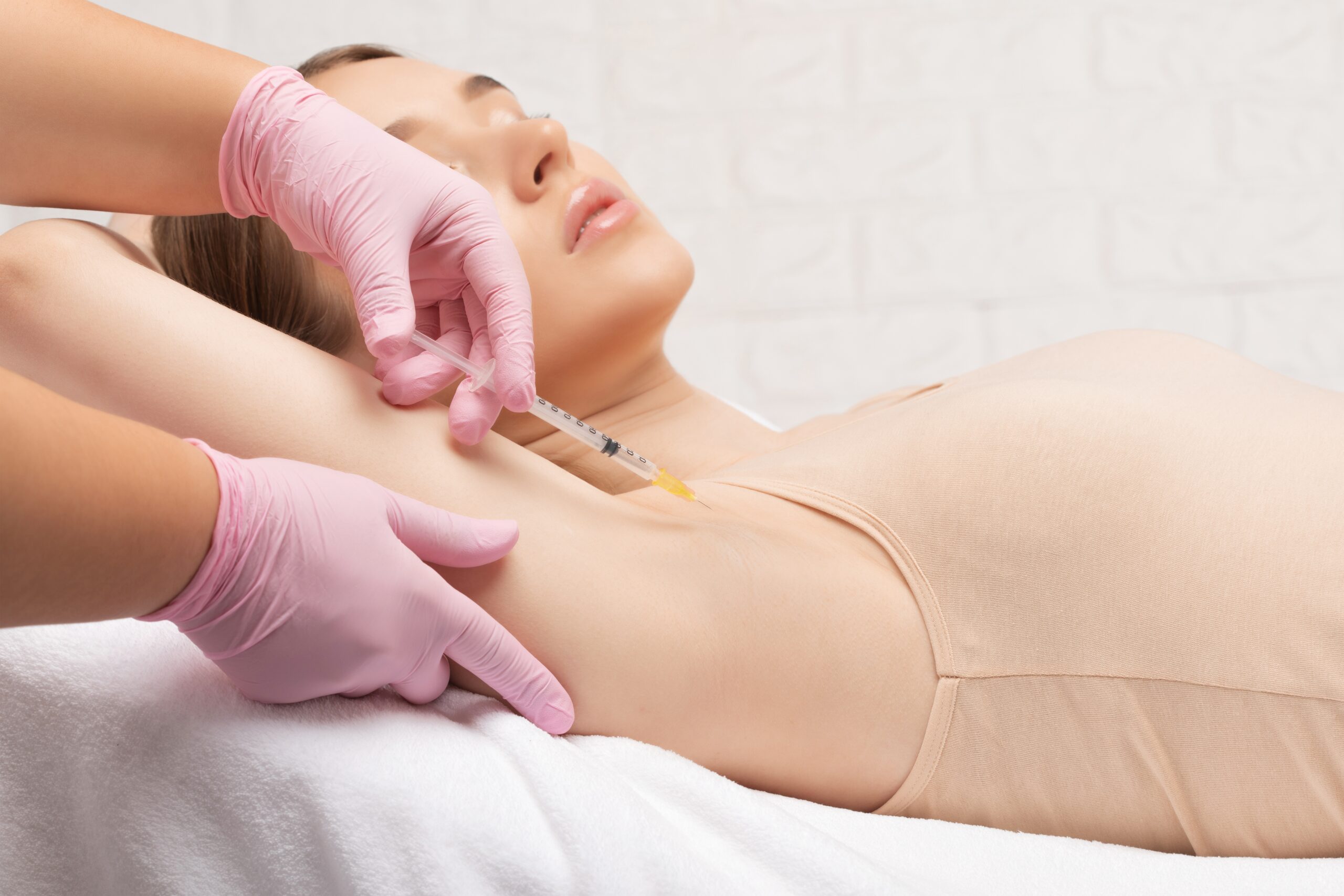 A woman receiving Botox injections in her armpits to treat hyperhidrosis