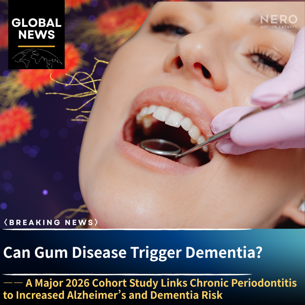 Chronic Periodontitis Linked to Alzheimer’s and Dementia Risk, Major 2026 Cohort Study Finds