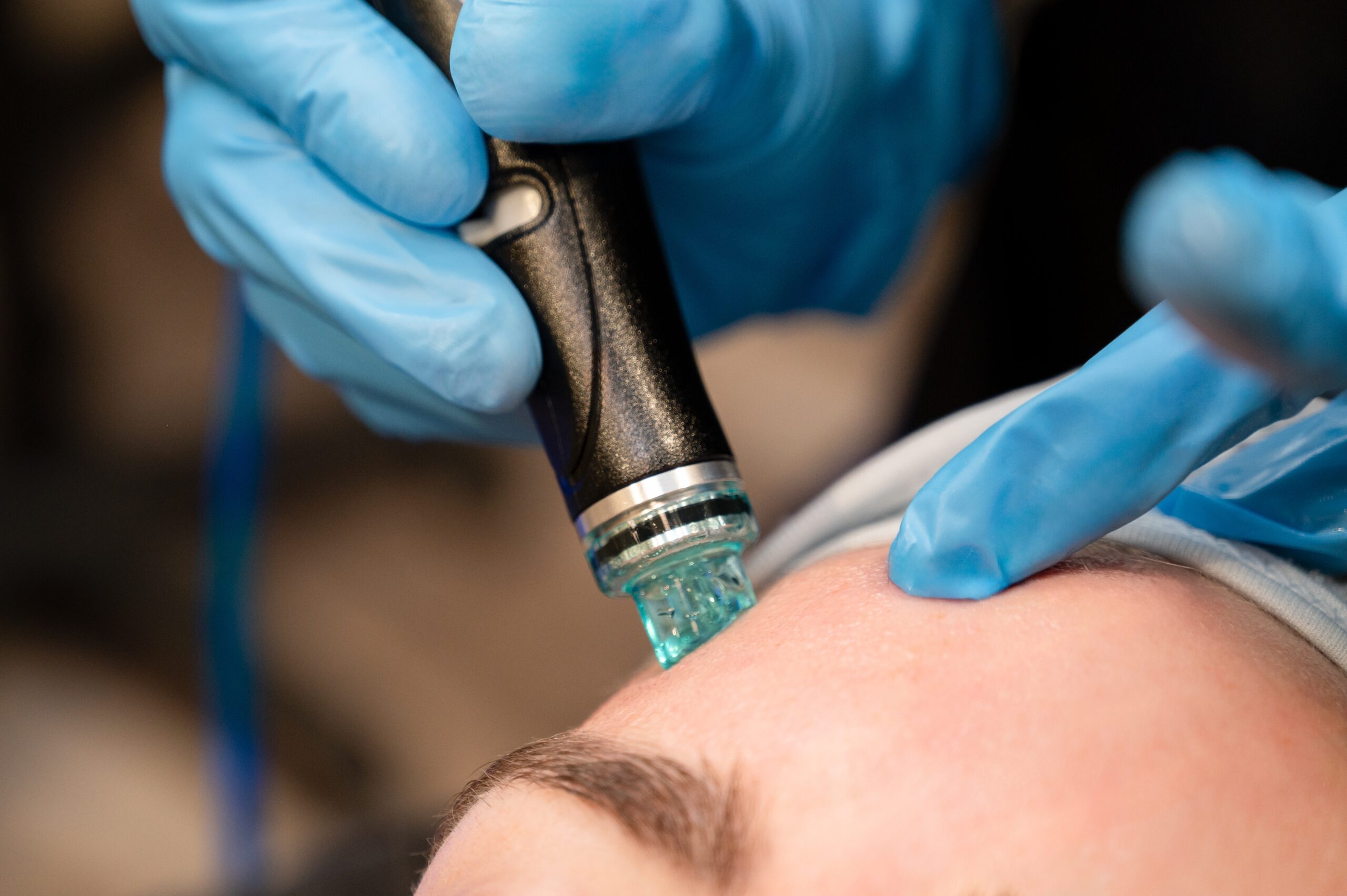 Close-up of a doctor's hands during a HydraFacial procedure.