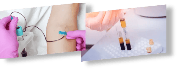 Blood collection before regenerative treatment at Pruge Regen Clinic.