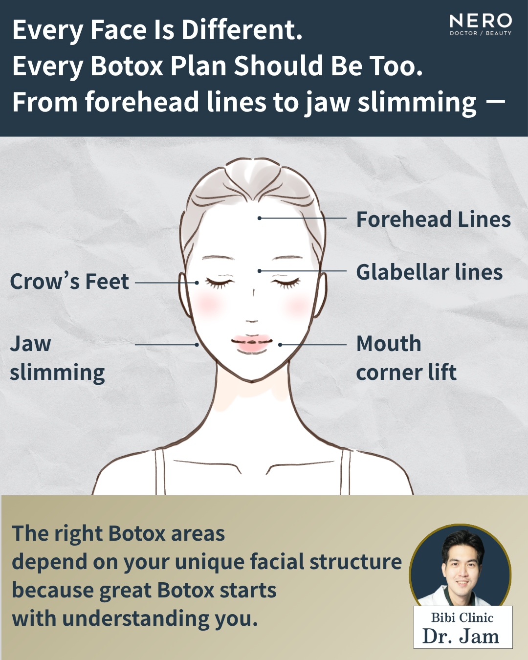 Various Botox Injection Sites1