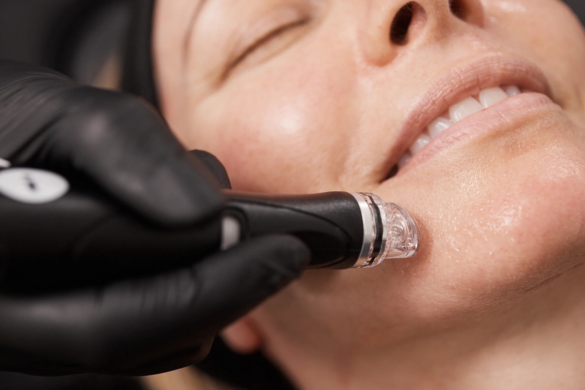 woman receiving a HydraFacial treatment
