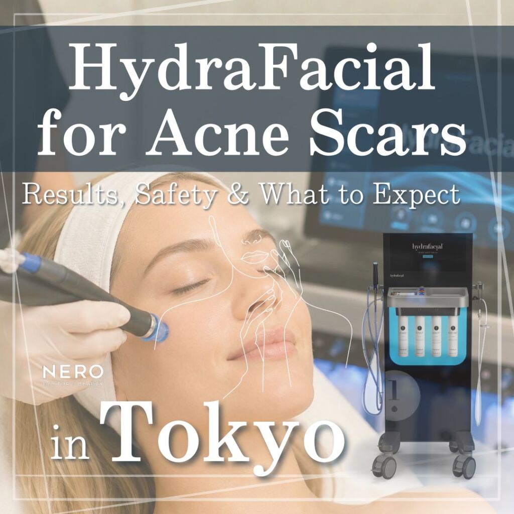 HydraFacial for Acne Scars in Tokyo: Results, Safety, and What To Expect