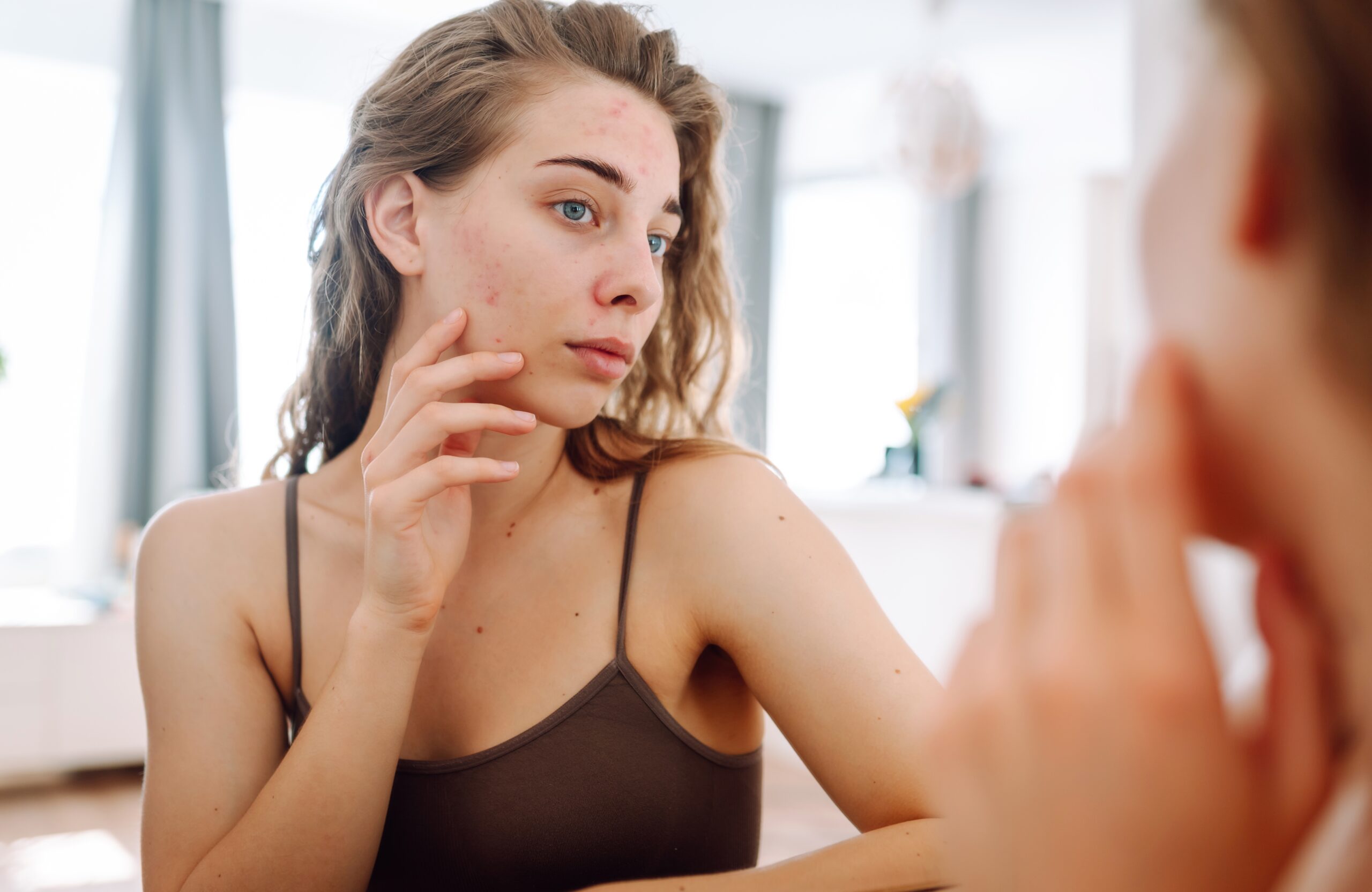 Woman considering Sculptra vs Radiesse treatment in Tokyo
