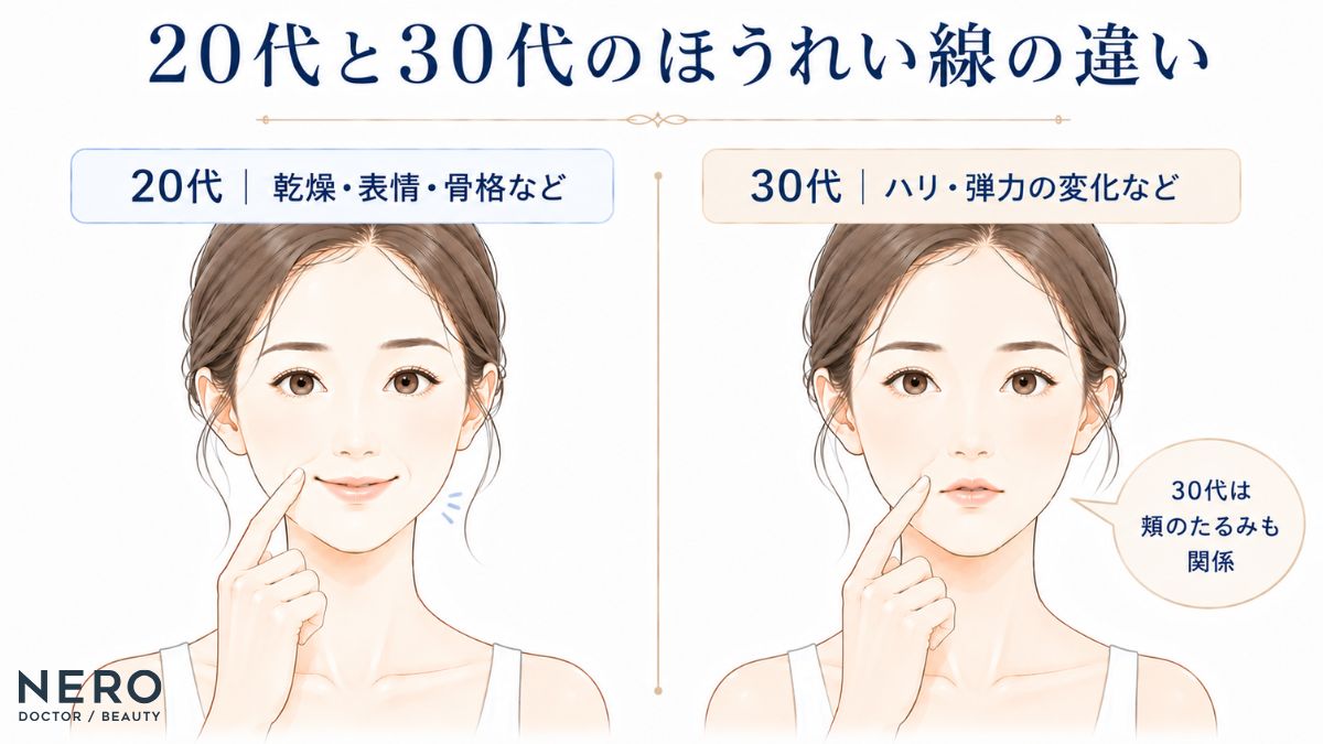 原因や見え方など、ほうれい線の違いを20代・30代と年代別にまとめた比較図
