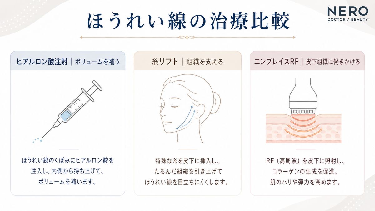 30代でほうれい線が気になる場合に用いられる美容医療の選択肢を比較した図