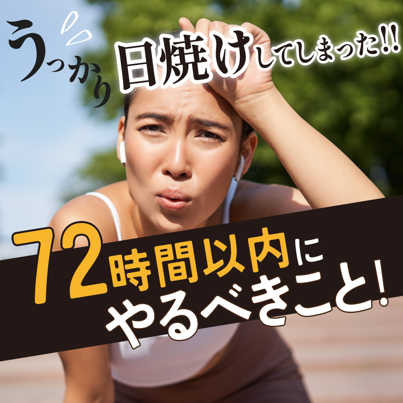 うっかり日焼けをしてしまったら何をしたら良い？72時間以内にやるべきこと！