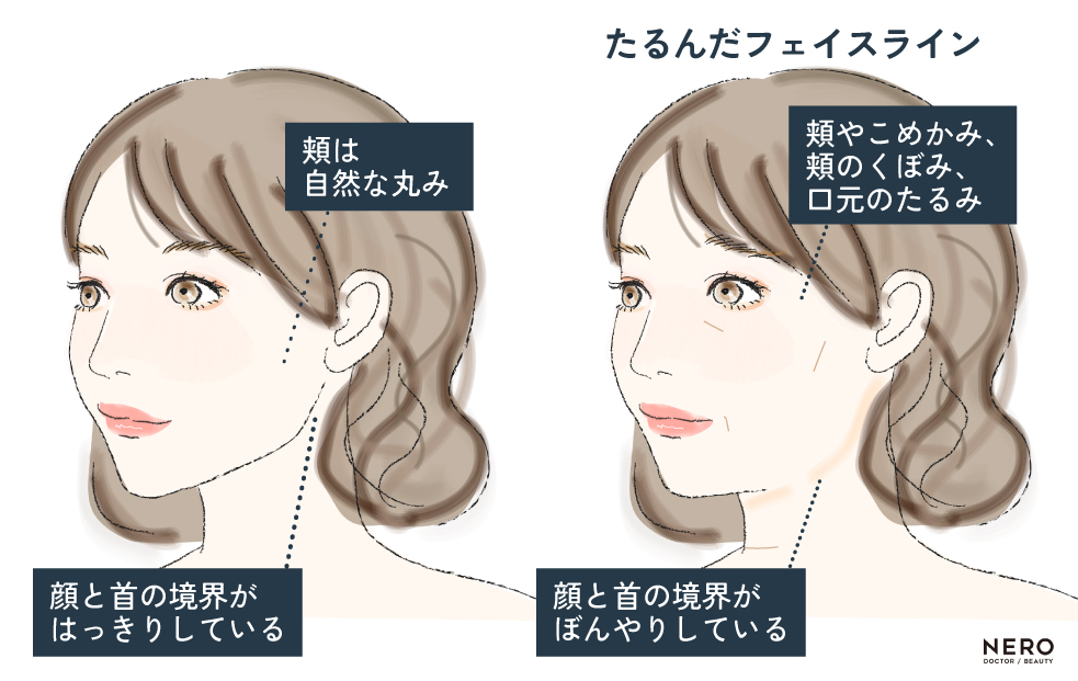 横顔美人目指さない？オージーカーブやEライン、その他ポイントを大解説！