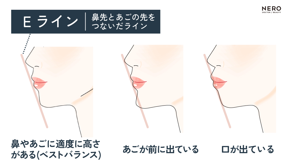 横顔美人目指さない？オージーカーブやEライン、その他ポイントを大解説！