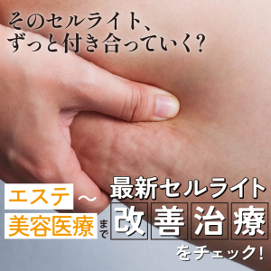 セルライトが太ももにできるのはなぜ？原因やセルフケア、美容医療を解説