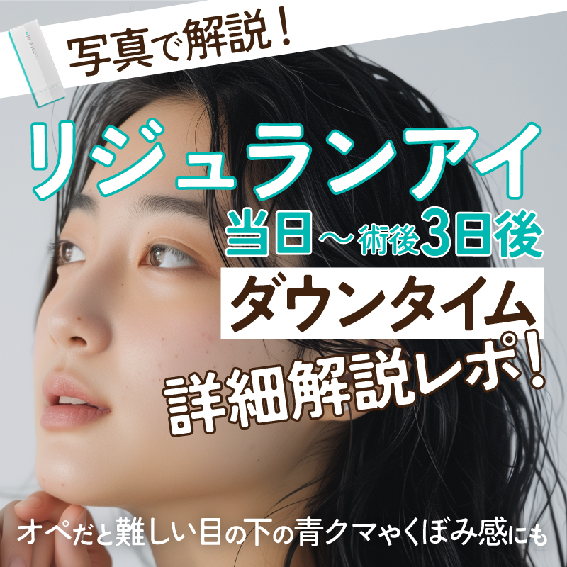 【写真で解説！】「リジュランアイ」の当日～術後3日後までのダウンタイム詳細解説レポ！【オペだと難しい目の下の青クマやくぼみ感にも】