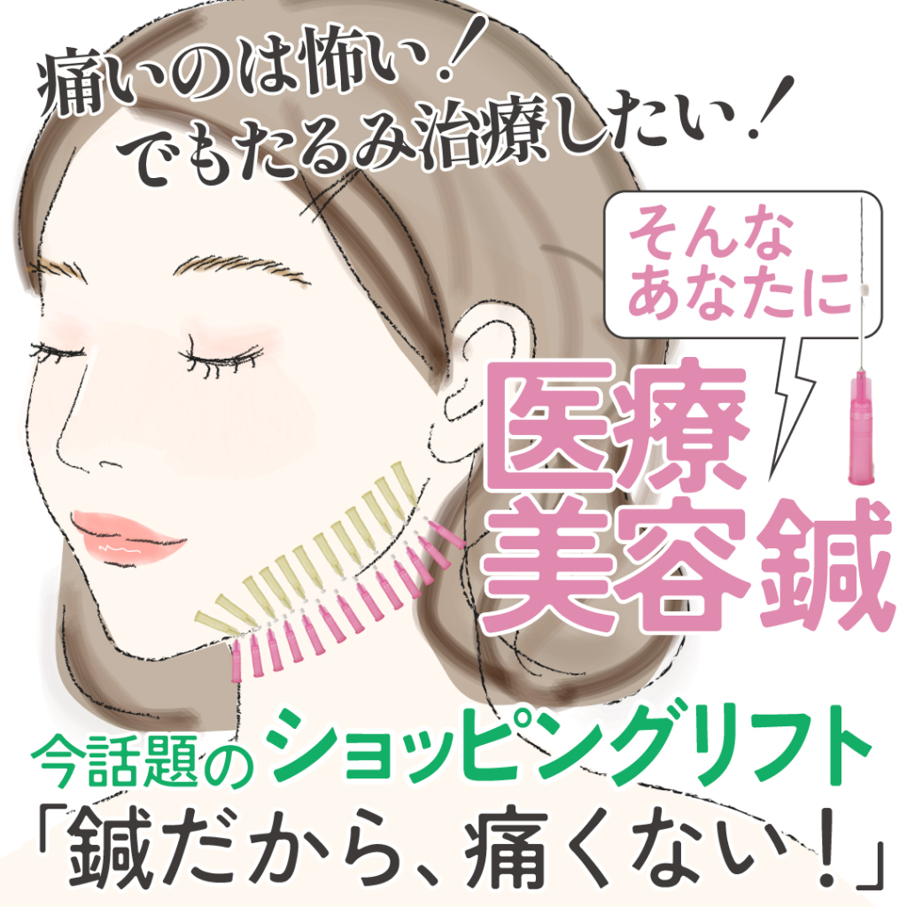 痛いのは怖い！でもたるみ治療したい！そんなあなたに【医療美容】「鍼だから、痛くない」今話題のショートスレッド（モノスレッド）通称ショッピングリフトを解説