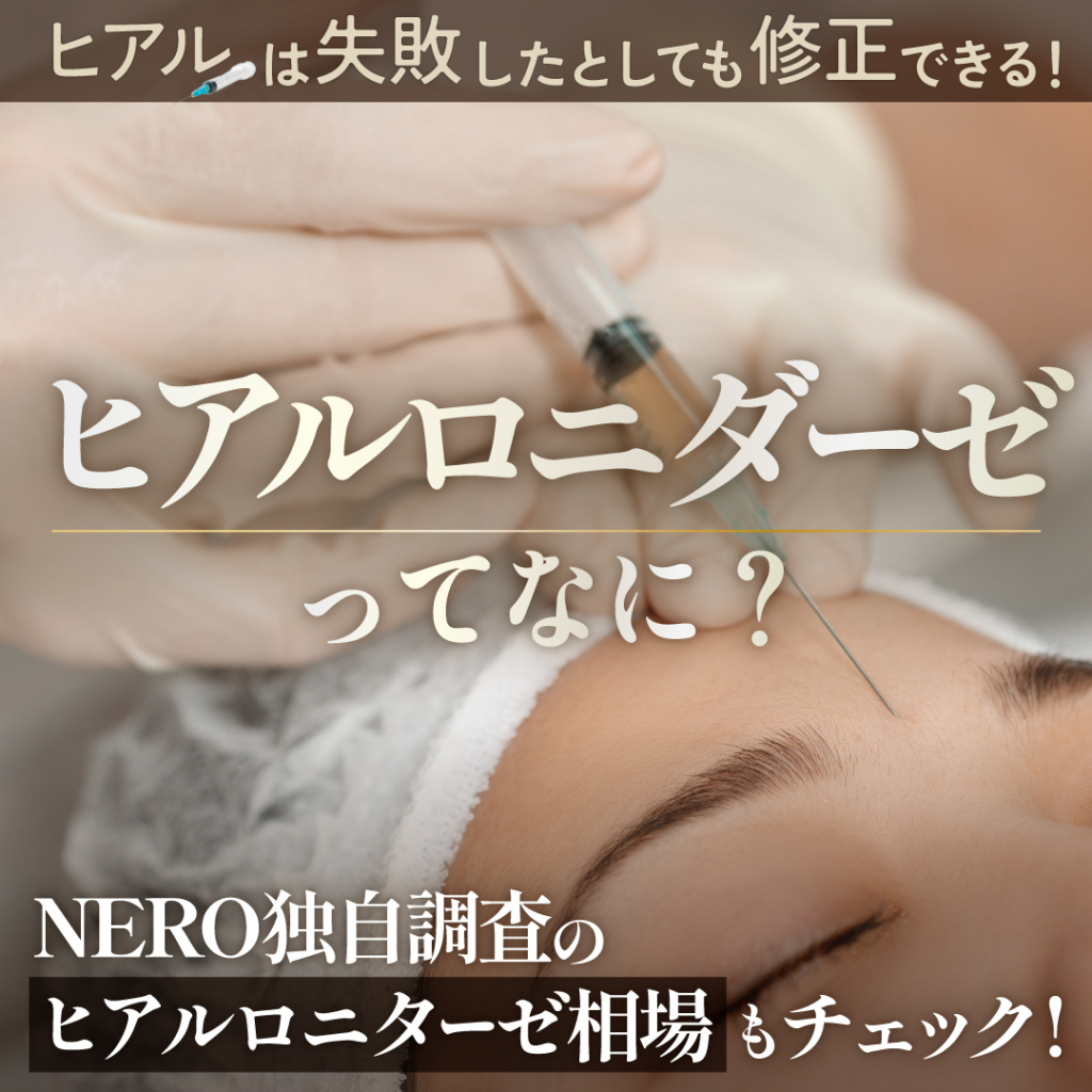 【失敗しても諦めないで、今すぐ相談】ヒアルロニダーゼってなに？ヒアルは失敗したとしても修正できる！NERO独自調査の【ヒアルロニダーゼ相場】もチェック。ヒアルは名医にお願いしよう