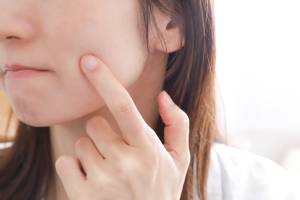 シミ取りレーザーの経過が不安な方へ｜ダウンタイム・色素沈着の見分け方とケア