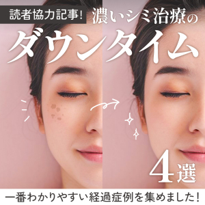 読者協力記事！濃いシミのダウンタイム4選！一番わかりやすい経過症例を集めました