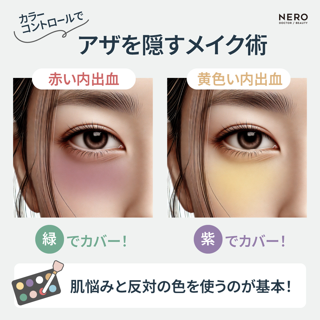 ちょっとしたテクニックで簡単に！ダウンタイムを上手に隠すメイクとファッションのコツ