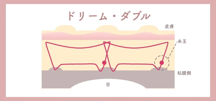 HAABクリニックの二重整形が人気のワケとは？美容Dr.ゆうた先生・田中優太院長の圧倒的な技術力のヒミツをNERO編集部が総力取材！