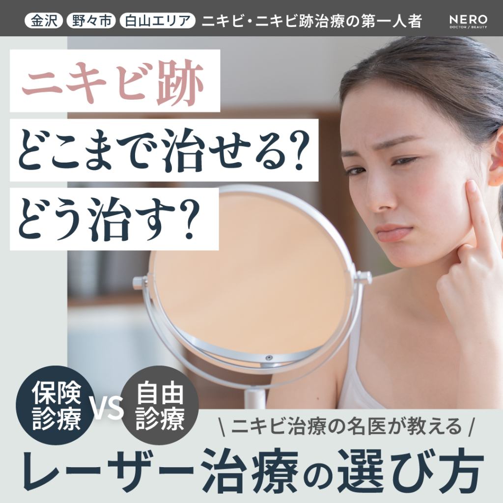 ニキビ跡治療には高額なレーザーがマスト?保険治療と自費治療のベストな選び方【金沢・とりい皮膚科クリニック監修】