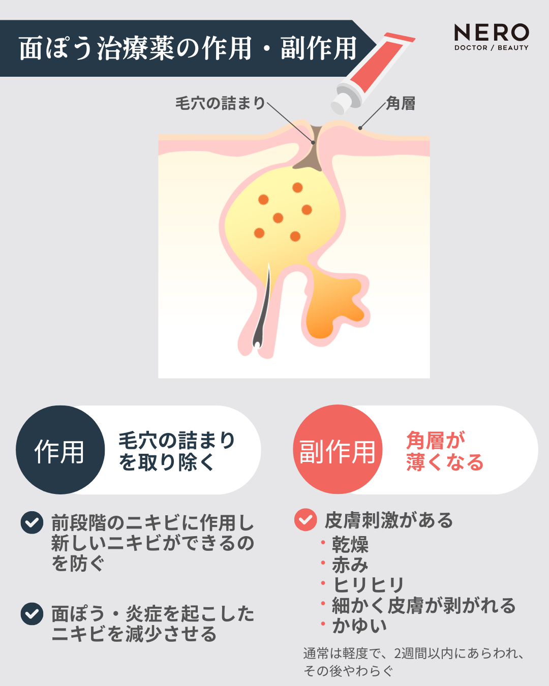金沢 ニキビ跡 レーザー とりい皮膚科クリニック ニキビやの第一歩は保険診療から！ (1)