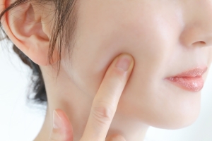 頬のニキビができたら｜ピーリングやレーザーが向いているのはどの症状？