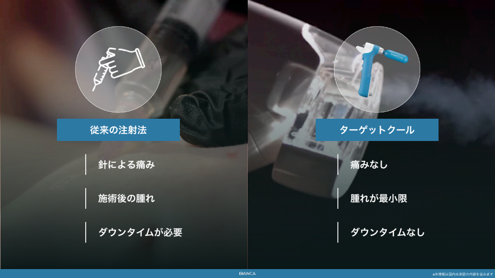 ターゲットクールでの肌育治療 痛くない？効果は？2025年大注目の美容治療をKOL医師が解説