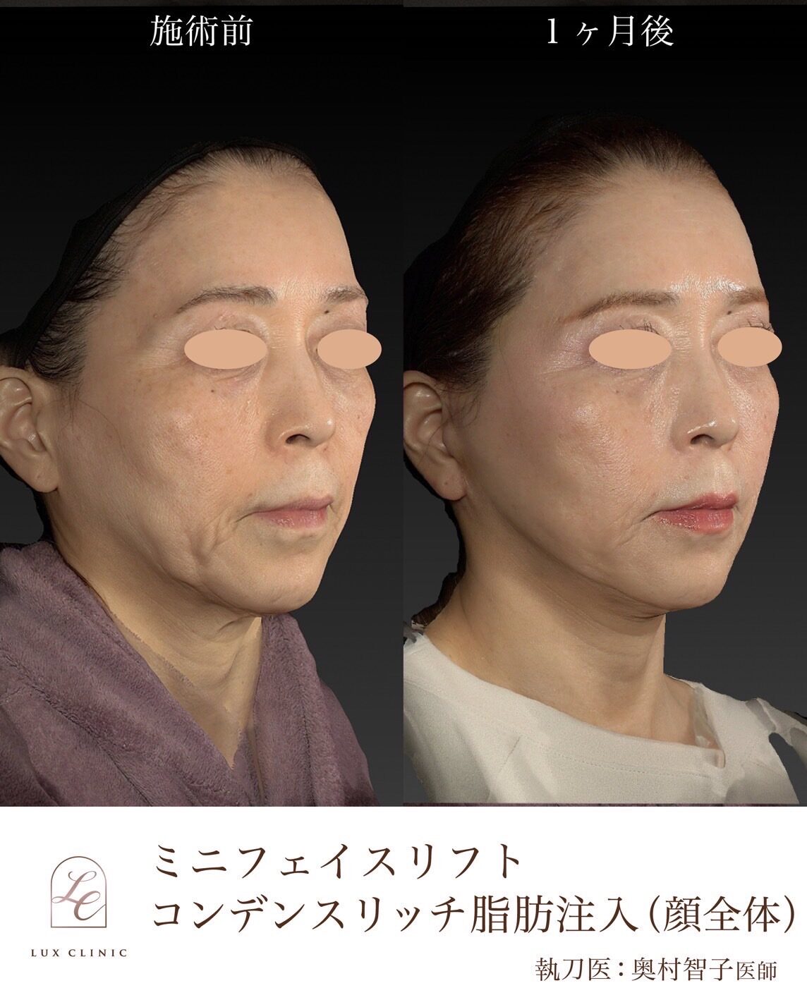 エイジングケア 何歳から