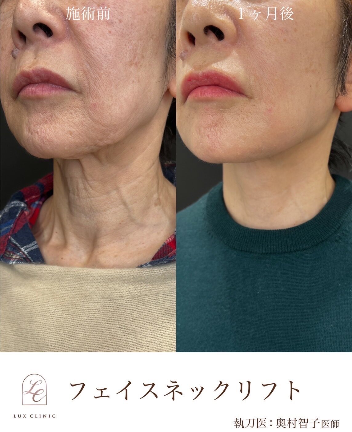 エイジングケア 何歳から