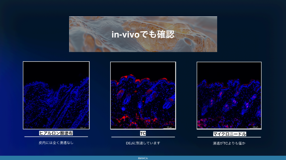 ターゲットクールでの肌育治療 痛くない？効果は？2025年大注目の美容治療をKOL医師が解説
