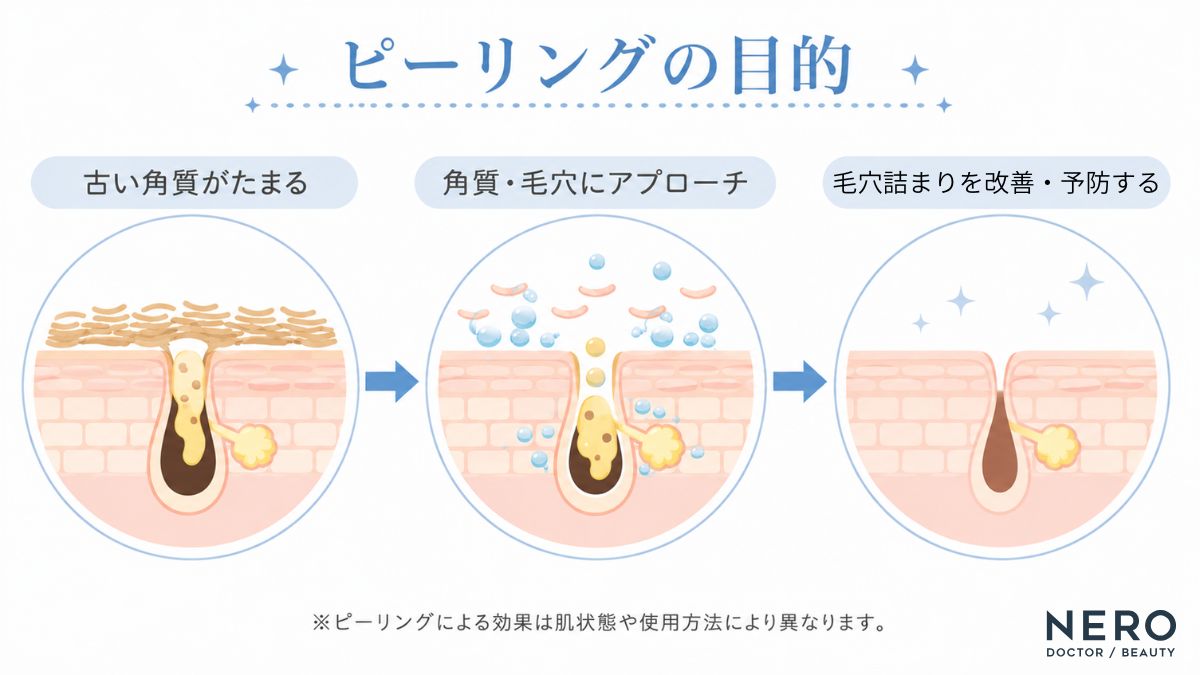 頬ニキビにピーリングが作用する仕組みをまとめた図