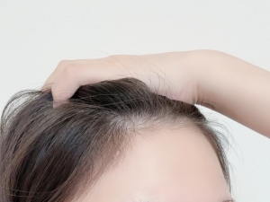 生え際アートメイクとは？効果・メリット・デメリットを徹底解説