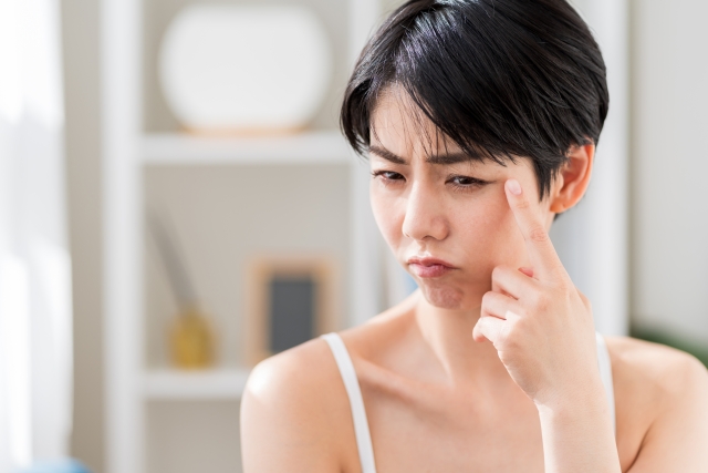 ボトックス効果はいつから目尻に現れる?長持ちさせるコツも