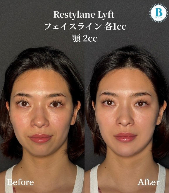 バンコクの美容クリニック「Bibi Clinic(ビビクリニック)」で日本クオリティの施術を体験