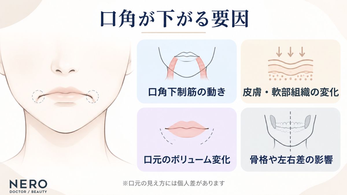 口角が下がって見える主な原因を整理した図