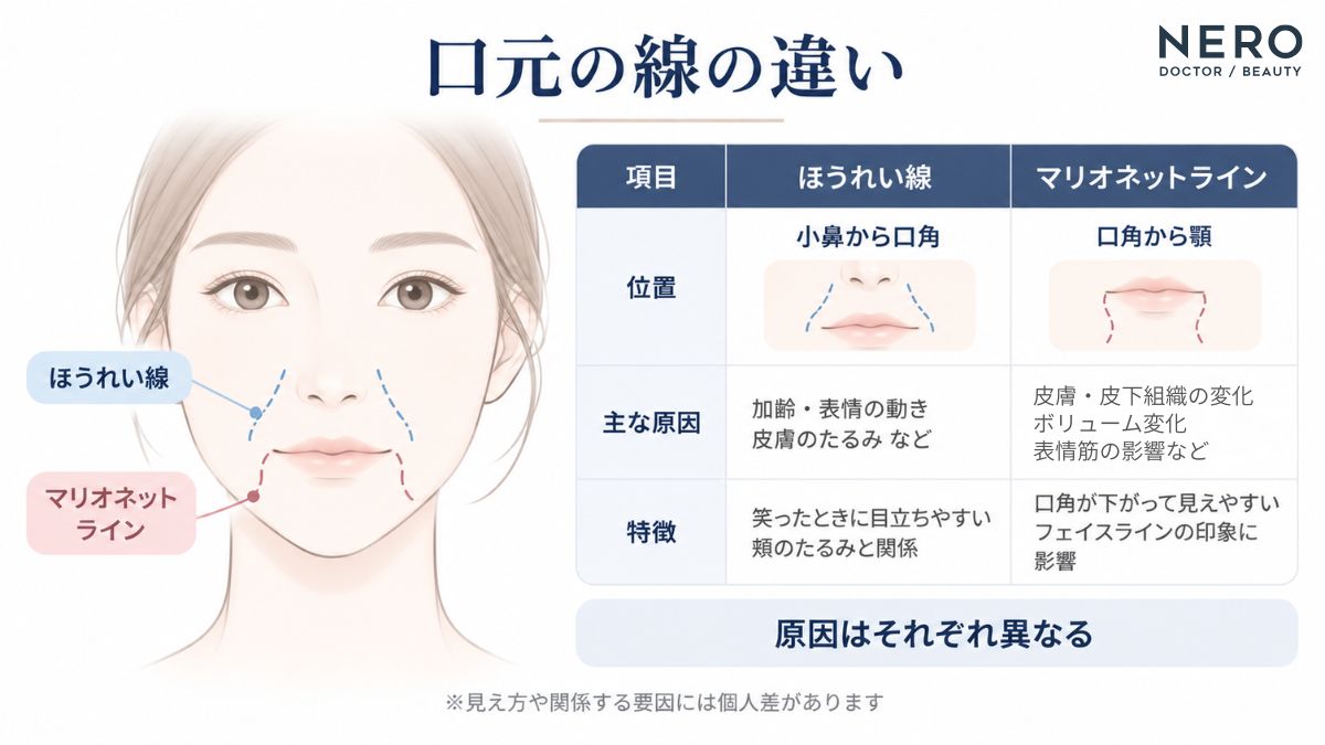 ほうれい線とマリオネットラインの位置を比べた表