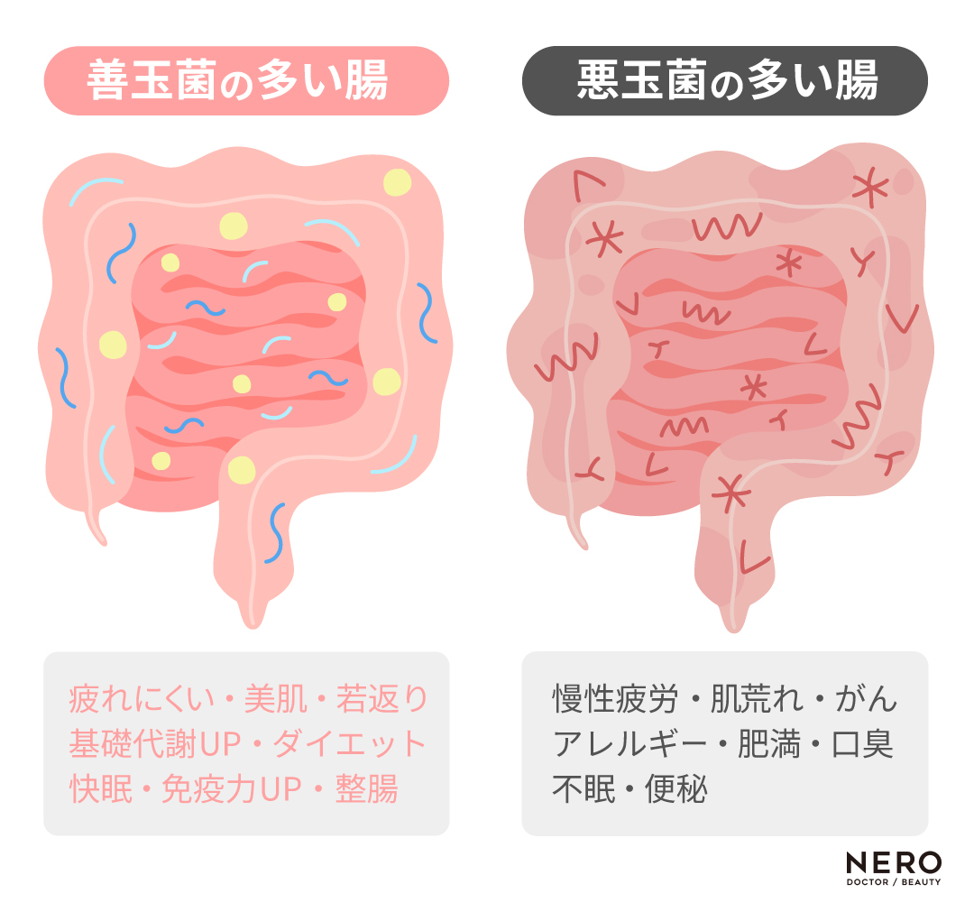 2025年、美容医療で腸活革命！発酵×美容の新常｜NERO DOCTOR / BEAUTY（美容医療）
