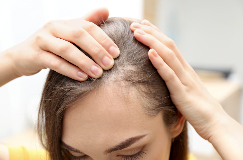 薄毛　女性　再生医療×薄毛：女性の「FAGA治療」進化中 「まさか自分が」から始まる、30代女性の薄毛治療白書。 ―育毛サロンより効果的な、医療の選択肢とは？｜NERO DOCTOR / BEAUTY（美容医療）