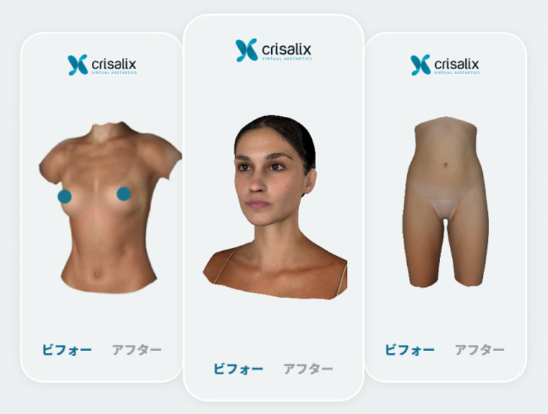 あなたの“理想顔”はAIシュミレーターが導く?美容医療におけるAI予測 AI活用の今と未来|NERO DOCTOR / BEAUTY(美容医療)