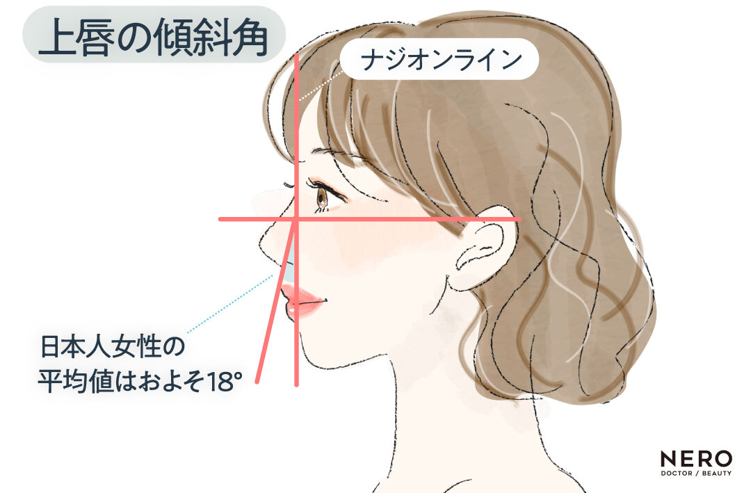 上唇 傾斜角 オージーカーブって何?Eラインとの違いと最新横顔バランス論|NERO DOCTOR / BEAUTY(美容医療)