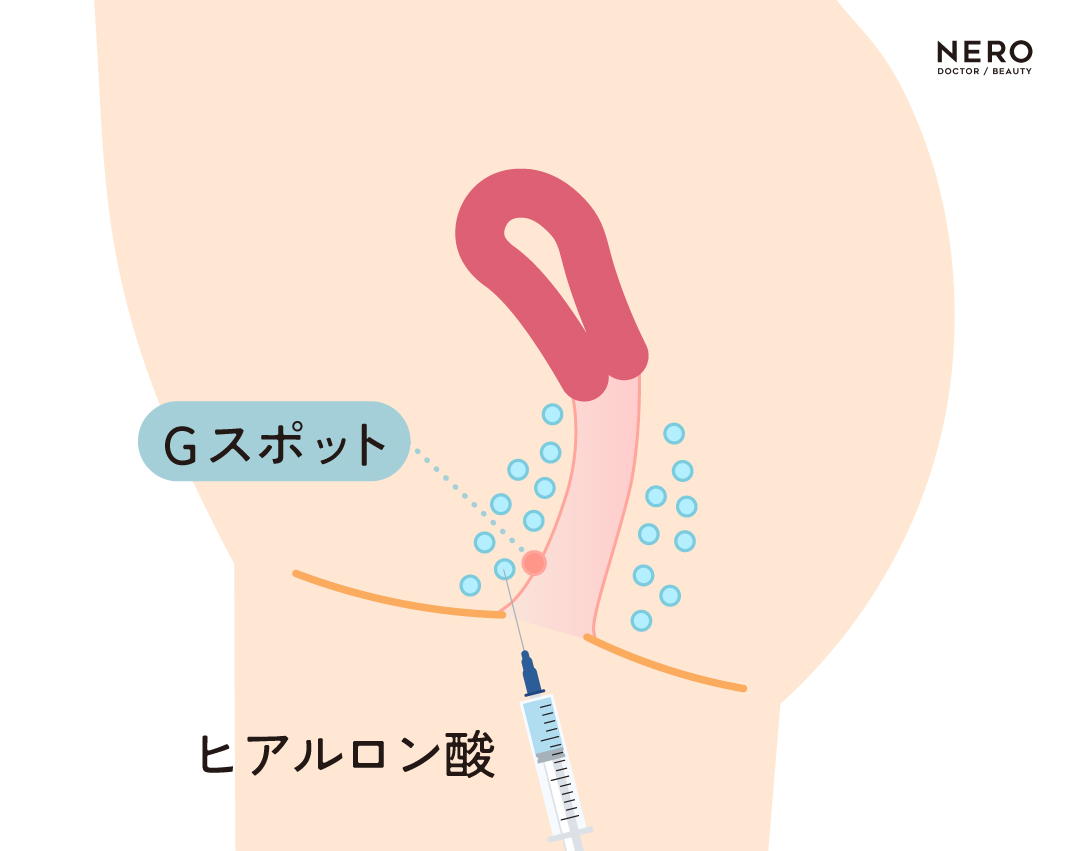 膣圧測定でわかる「“締まる膣”の基準とは？/男性女性の求める性器・性感」について、医学的観点で調査！