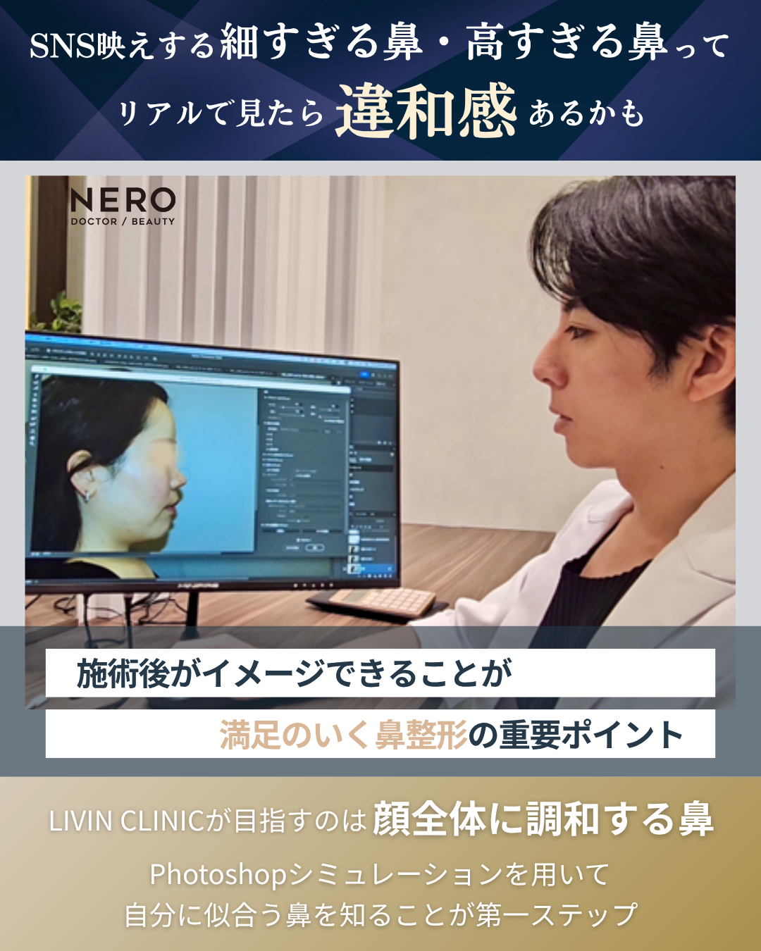 鼻のコンプレックスは鼻整形でどう変わる？ LIVIN CLINICのリアルなシミュレーションで理想の鼻を見つける
