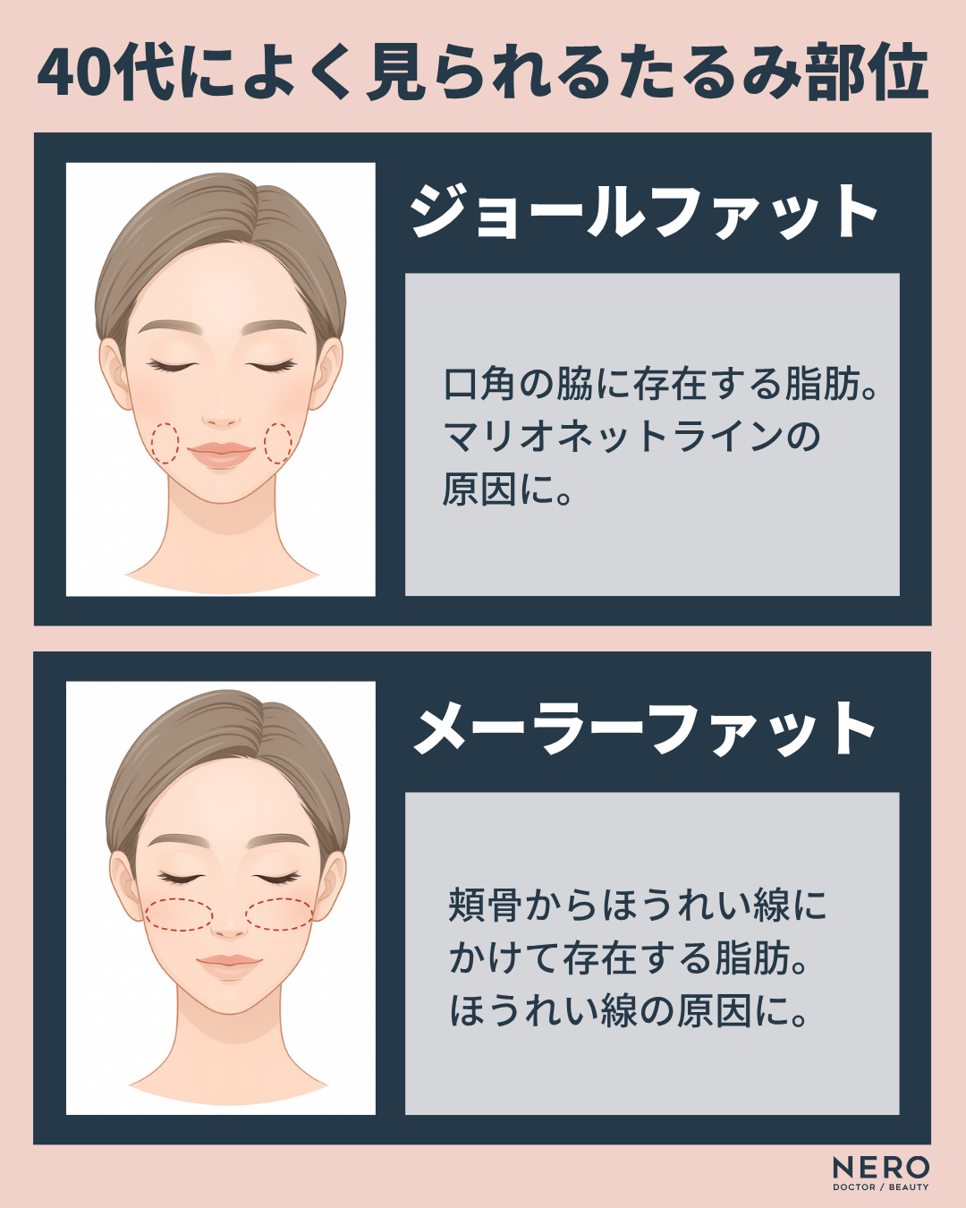 エイジングケアは何歳から？“老け見え”の悩みが深まる30代40代へ自然で美しい変化をもたらすルクスクリニックの選択肢を