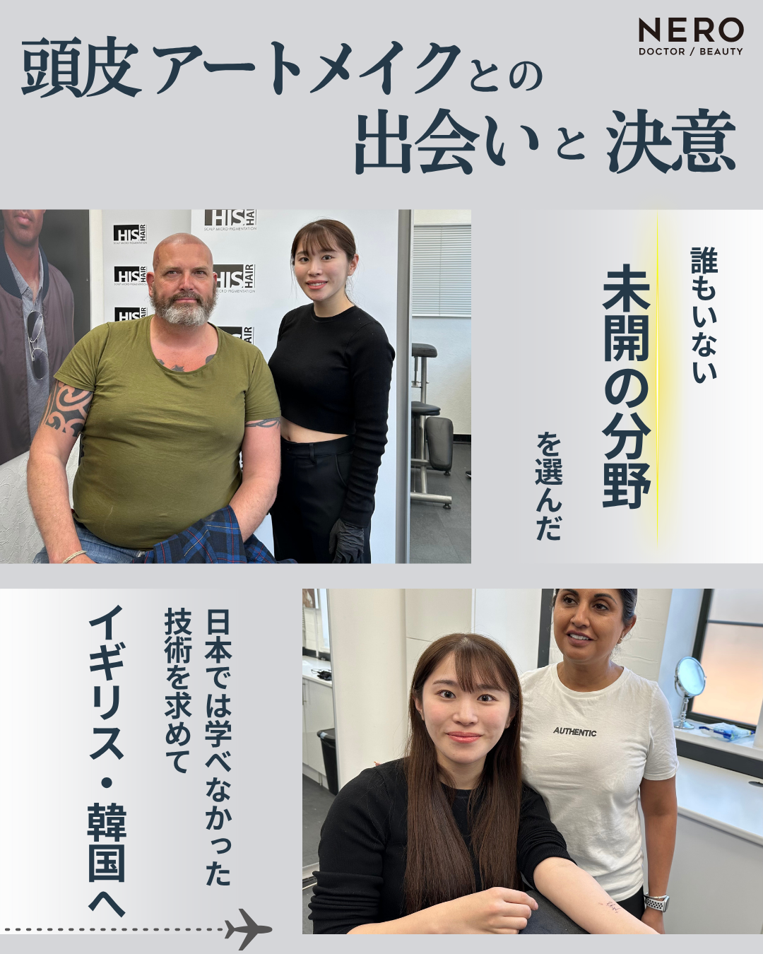 英国式頭皮アートメイク専門看護師 吉田 れいさんへインタビュー！頭皮アートメイクのパイオニアが貫く手打ち技術と悩みに寄り添う信念